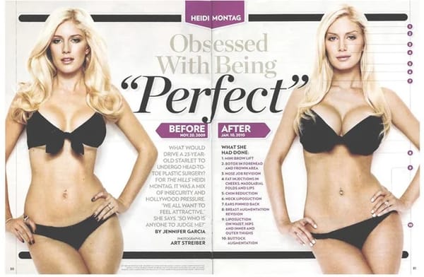 Do You Remember: Heidi Montag’s Ten Cosmetic Surgeries in One Day
