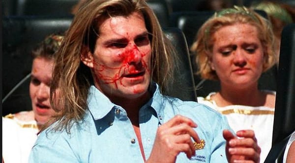 Do You Remember: When Fabio Was Hit In the Face By a Flying Goose While Riding a Rollercoaster?